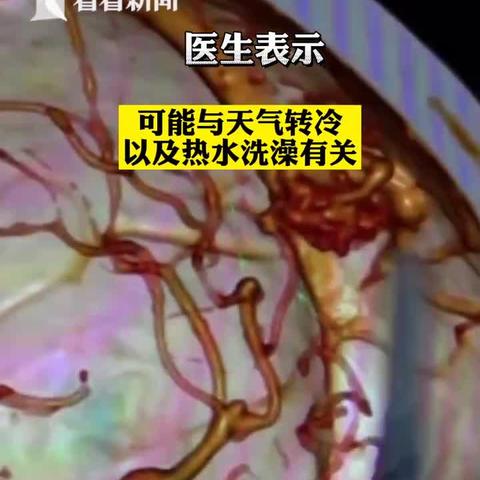 突发头疼4小时，头疼4个小时 