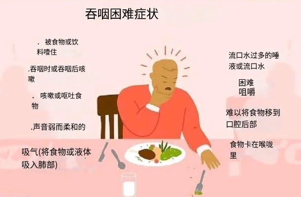 突发吞咽功能丧失，突发的吞咽困难 